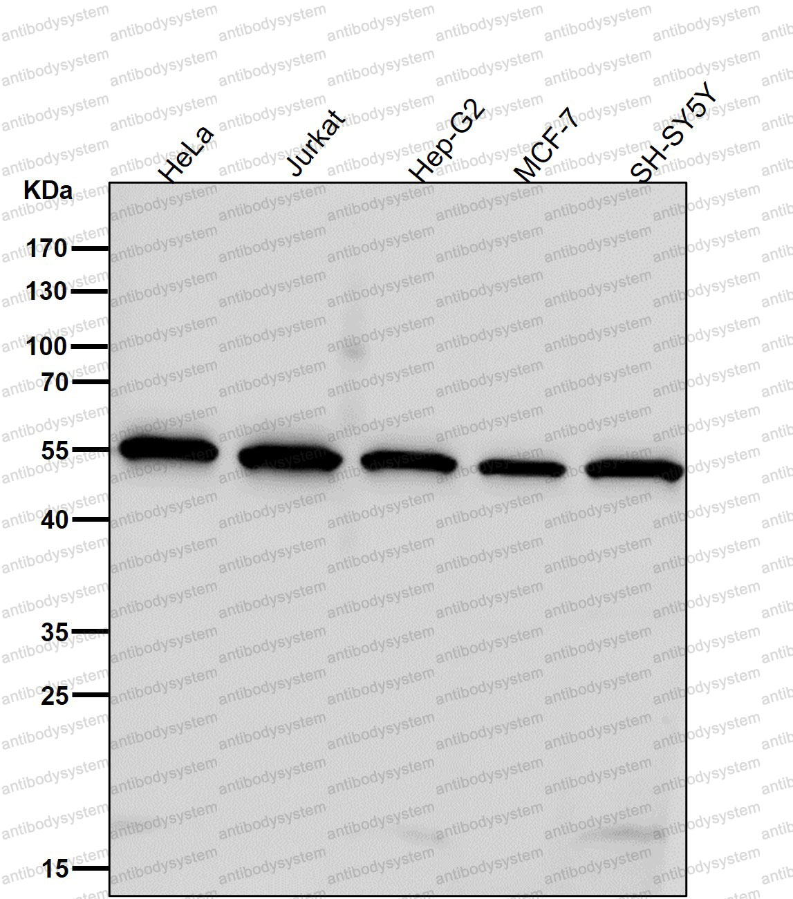 Anti-SHB Antibody (R1B78)