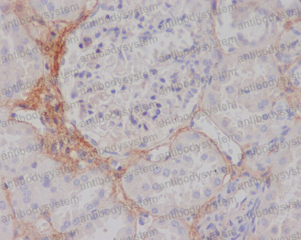 Anti-TGFBI Antibody (R1B27)