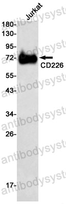 Anti-CD226/DNAM-1 Antibody (R2G59)