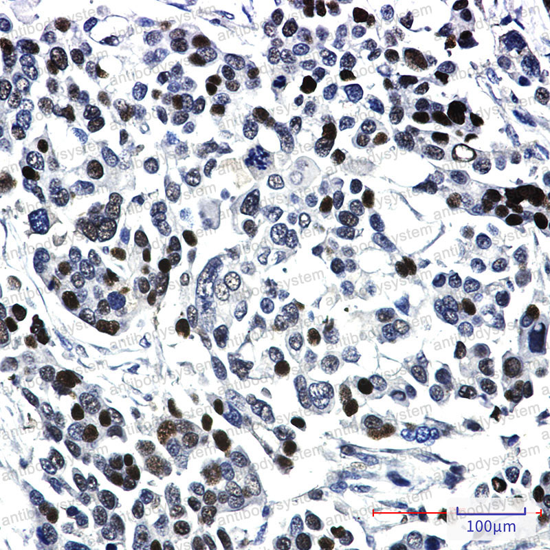 Anti-NCOA1 Antibody (R2G63)