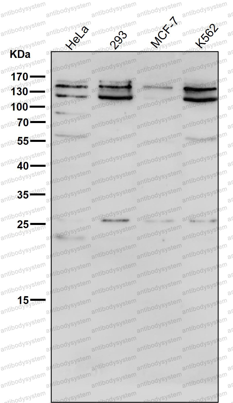 Anti-NCOA1/SRC1 Antibody (R2G62)