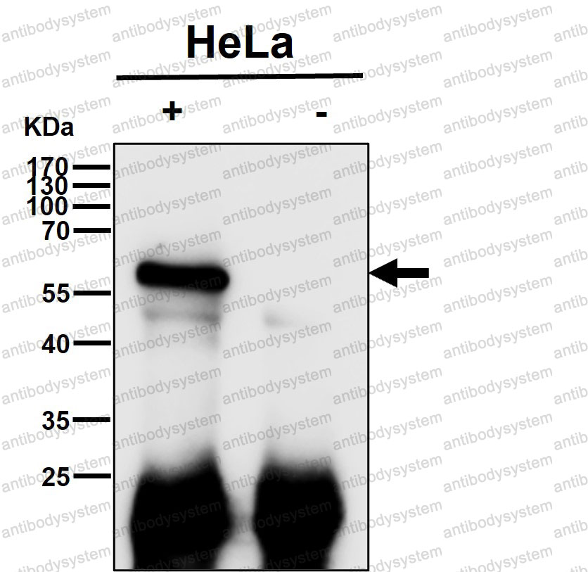 Anti-SMAD2 Antibody (R2G64)