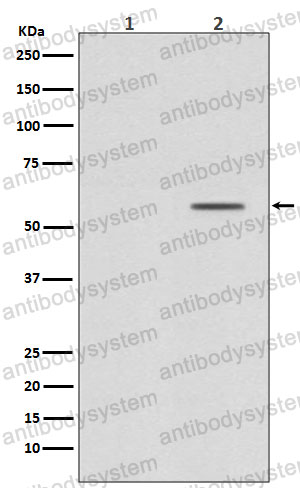 Anti-Phospho-SMAD2 (S250) Antibody (R2G65)