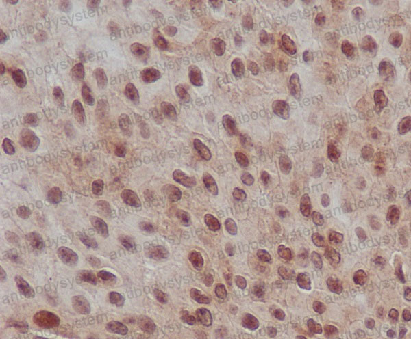 Anti-Phospho-SMAD2 (S255) Antibody (R2G66)