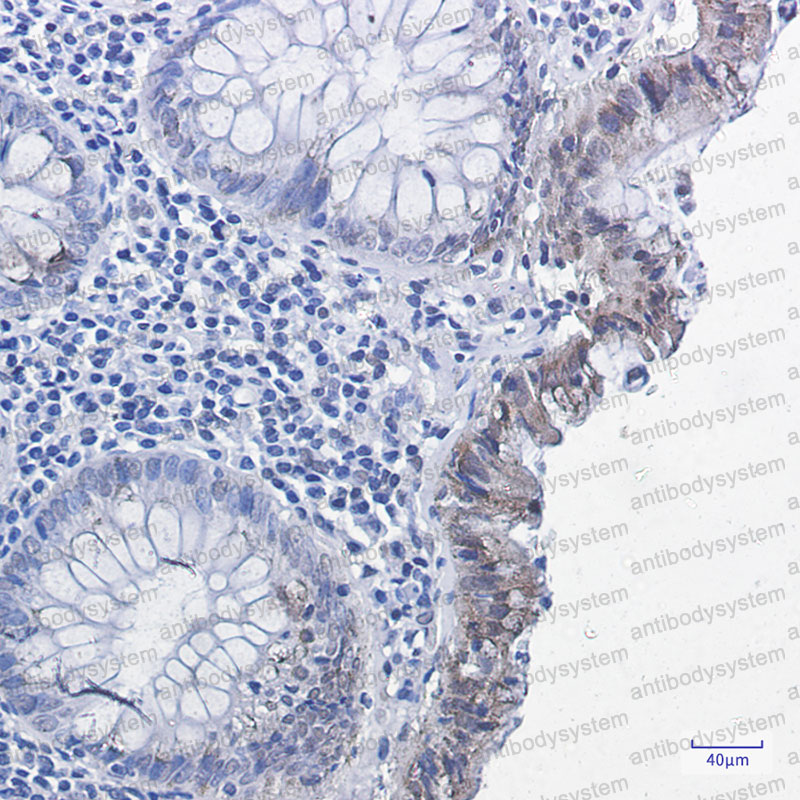 Anti-Phospho-SMAD2 (Ser255) Antibody (R2G67)