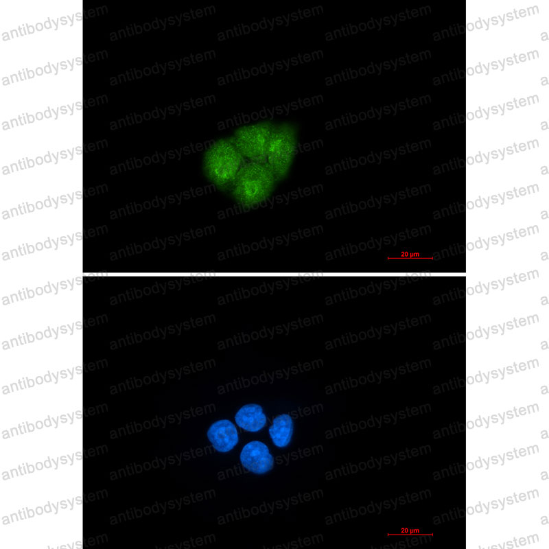 Anti-SMAD2 Antibody (R2G69)