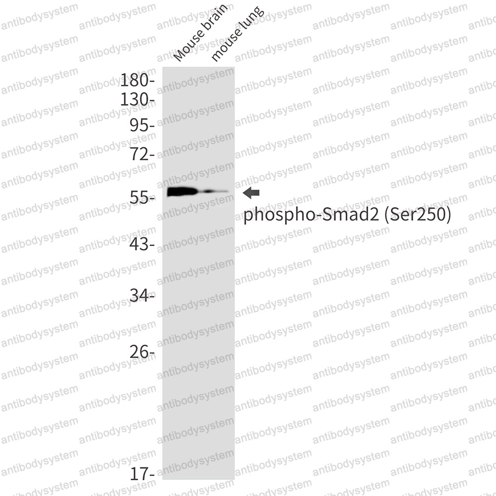 Anti-Phospho-SMAD2 (Ser250) Antibody (R2G68)