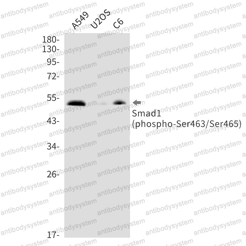 Anti-Phospho-SMAD1 (Ser463/Ser465) Antibody (R2G70)