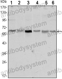 Western blot for Anti-STK11 Antibody (R3U12) ?>