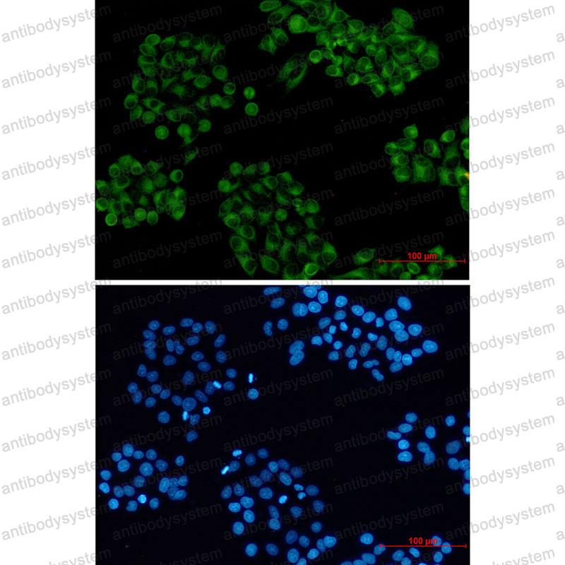 Anti-VAMP3 Antibody (R2G72)