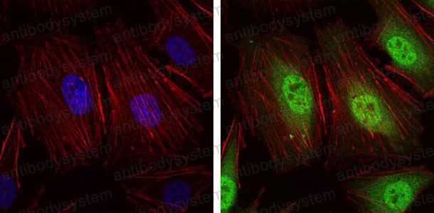 Immunofluorescence for Anti-NEDD8 Antibody (R3U13) ?>
