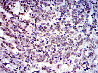 Immunohistochemical for Anti-NEDD8 Antibody (R3U13) ?>