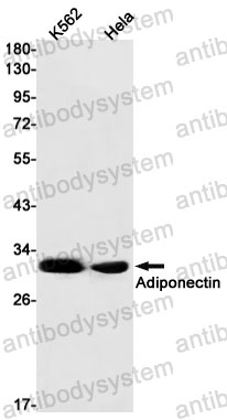 Anti-Adiponectin/ACRP30/ADIPOQ Antibody (R2G75)