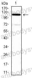 Western blot for Anti-ATP6AP1 Antibody (R3U17) ?>