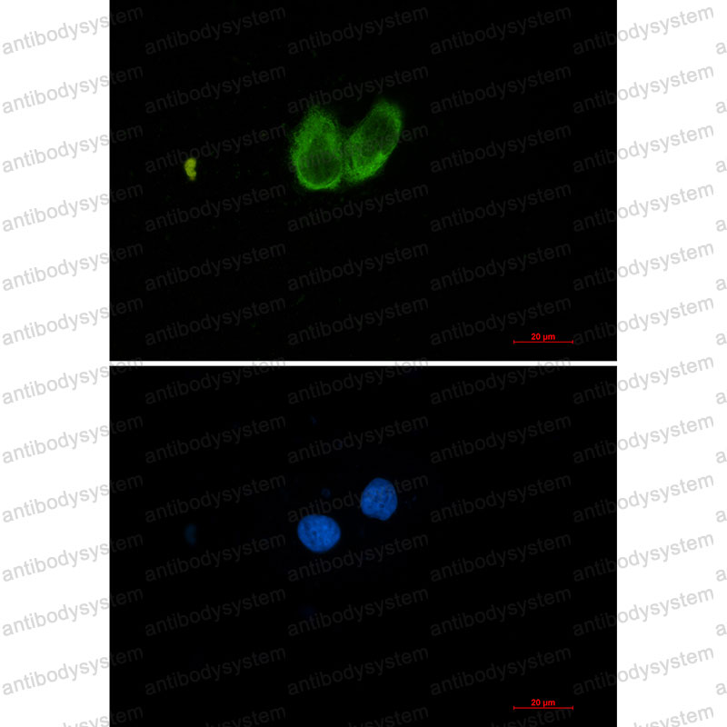 Anti-ZYX Antibody (R2G80)