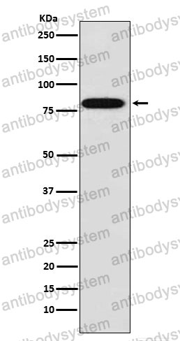 Anti-ZYX Antibody (R2G79)