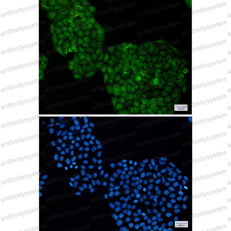 Anti-ADRM1 Antibody (R2G82)