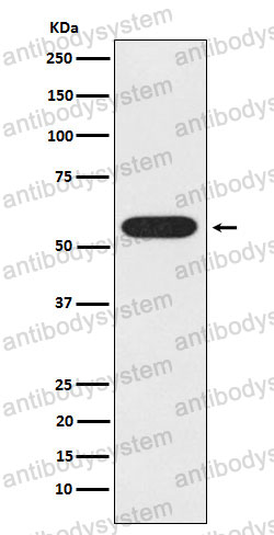 Anti-UAP1 Antibody (R2G83)