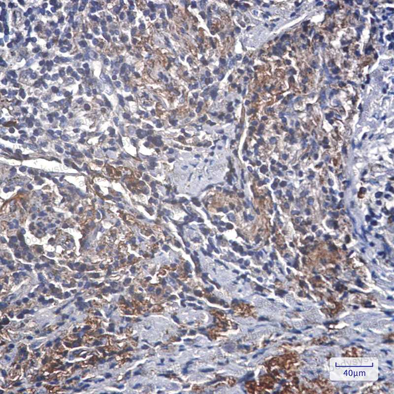 Anti-IGFBP7 Antibody (R2G87)