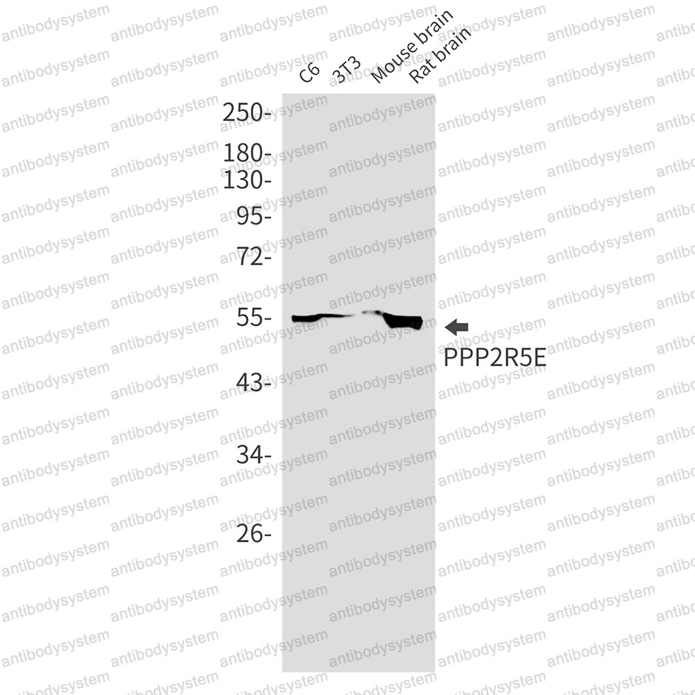 Anti-PPP2R5E Antibody (R2G98)