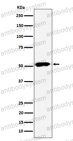 Anti-PPP2R5E Antibody (R2G96)