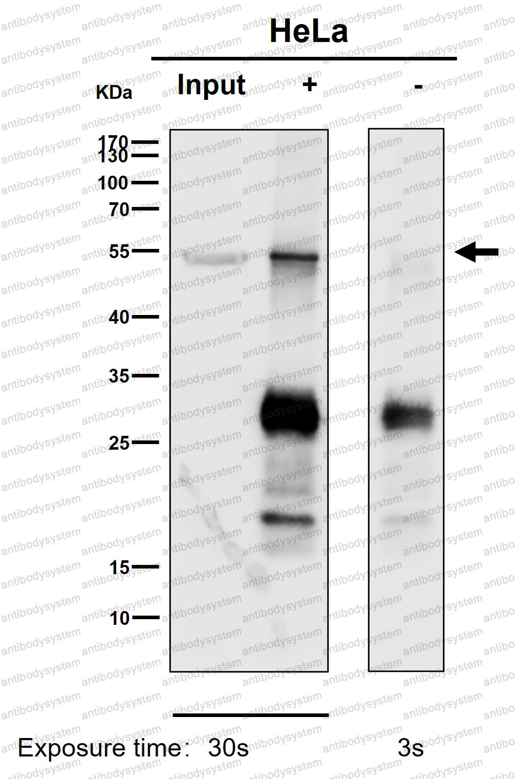 Anti-PPP2R5E Antibody (R2G97)