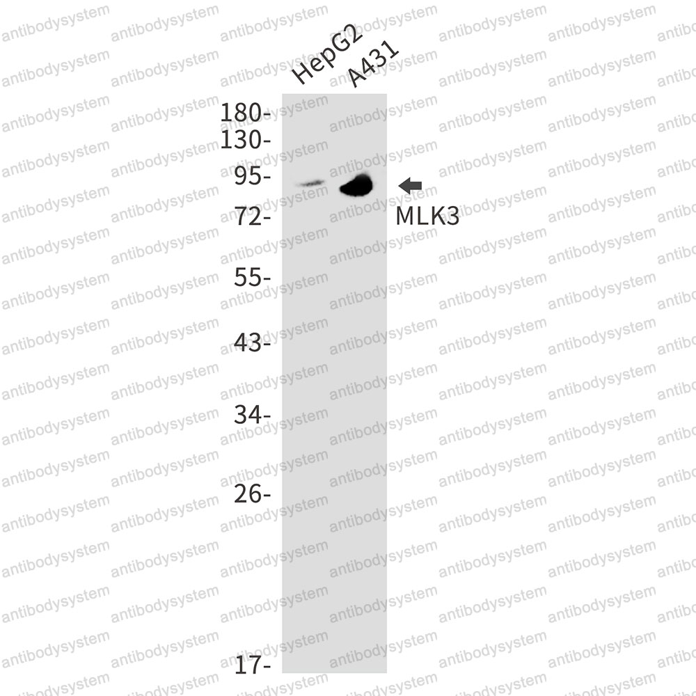 Anti-MAP3K11 Antibody (R2H12)