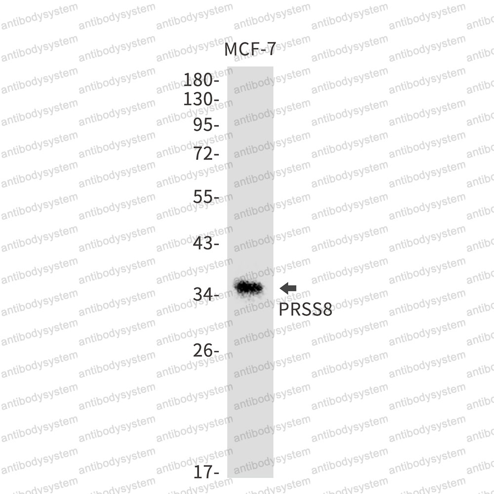 Anti-PRSS8 Antibody (R2H35)