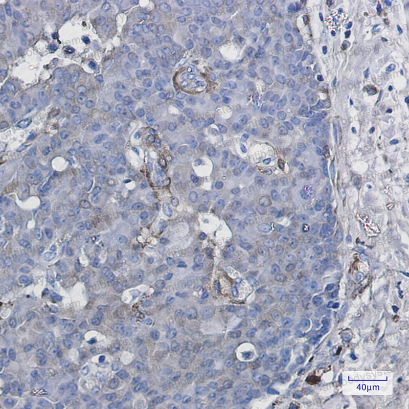 Anti-CYP1B1 Antibody (R2H45)