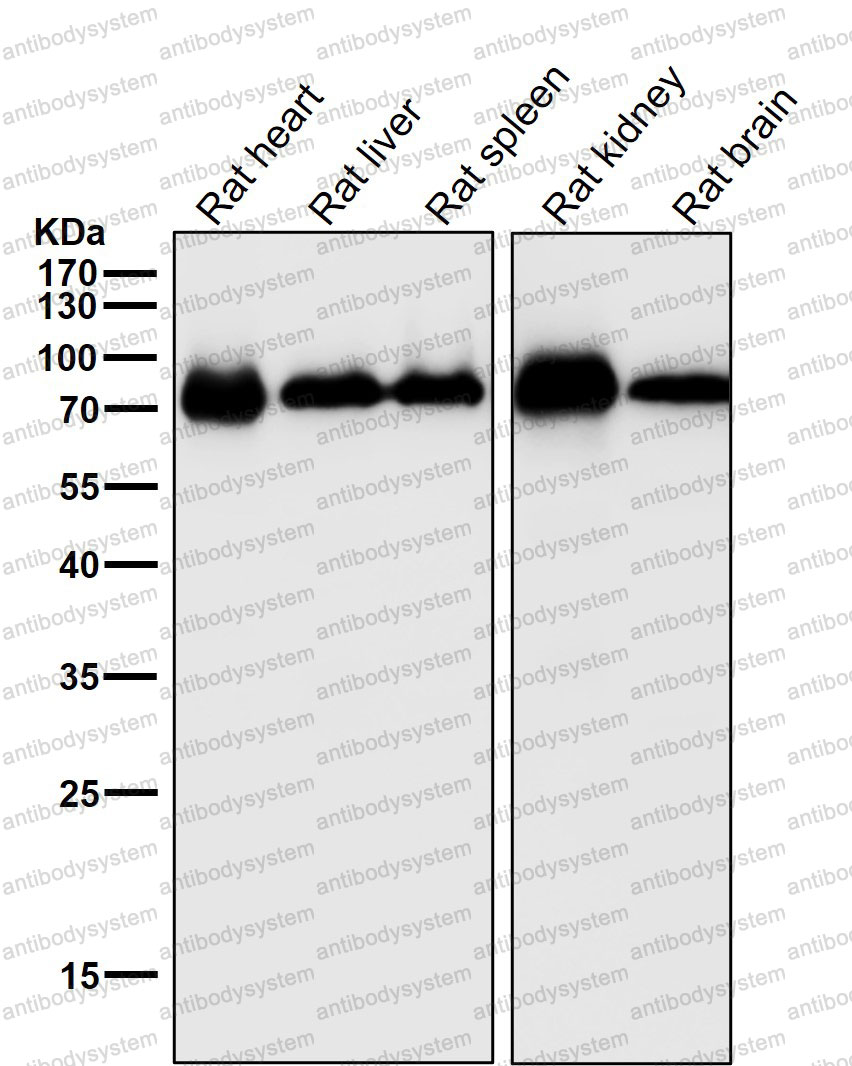 Anti-CYP1B1 Antibody (R2H44)