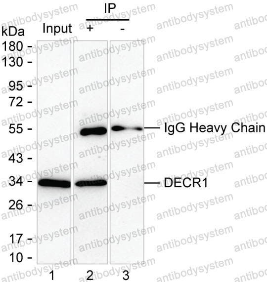 Immunoprecipitation for Anti-DECR1 Antibody (R3U52) ?>
