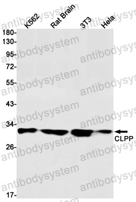 Anti-CLPP Antibody (R2H47)