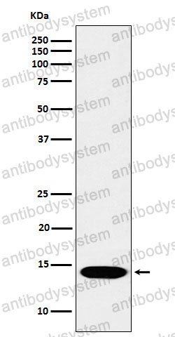 Anti-Histone H2B (monomethyl K116) Antibody (R2H54)