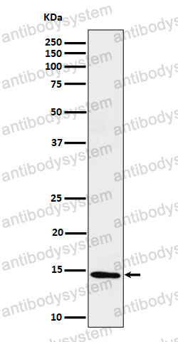 Anti-Histone H2B (formyl K116) Antibody (R2H49)