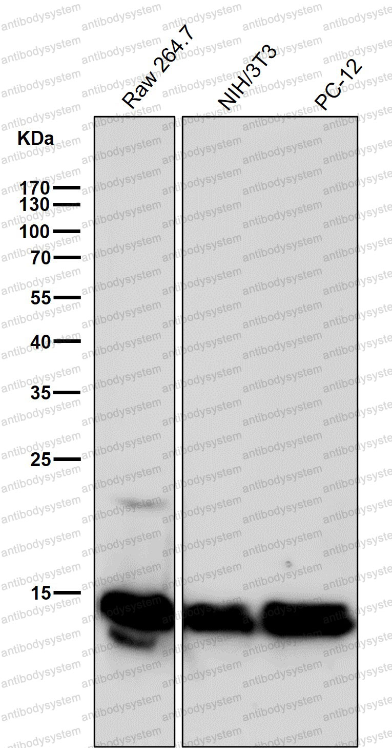 Anti-Histone H2B (crotonyl K12) Antibody (R2H50)