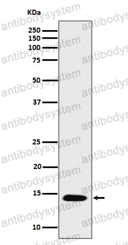 Anti-Histone H2B (acetyl K16) Antibody (R2H51)