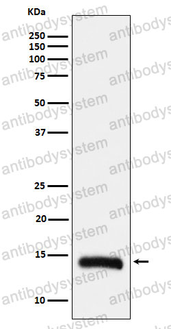 Anti-Histone H2B (formyl K108) Antibody (R2H52)