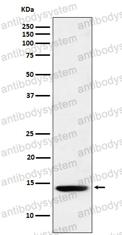 Anti-Histone H2B (formyl K120) Antibody (R2H53)