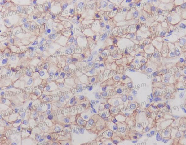 Anti-CA9 Antibody (R2H56)