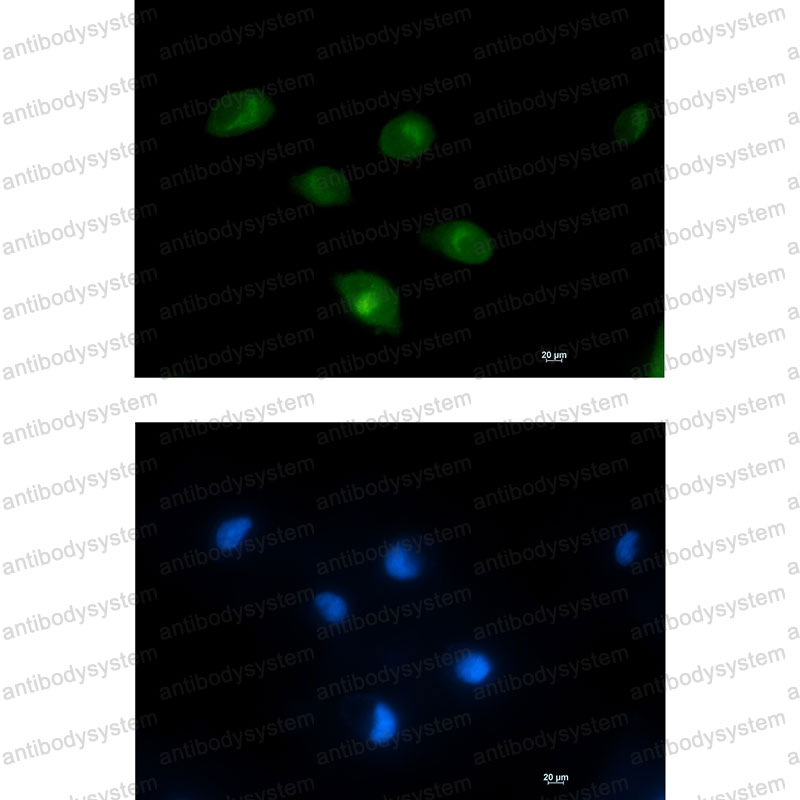 Anti-PCK2 Antibody (R2H57)