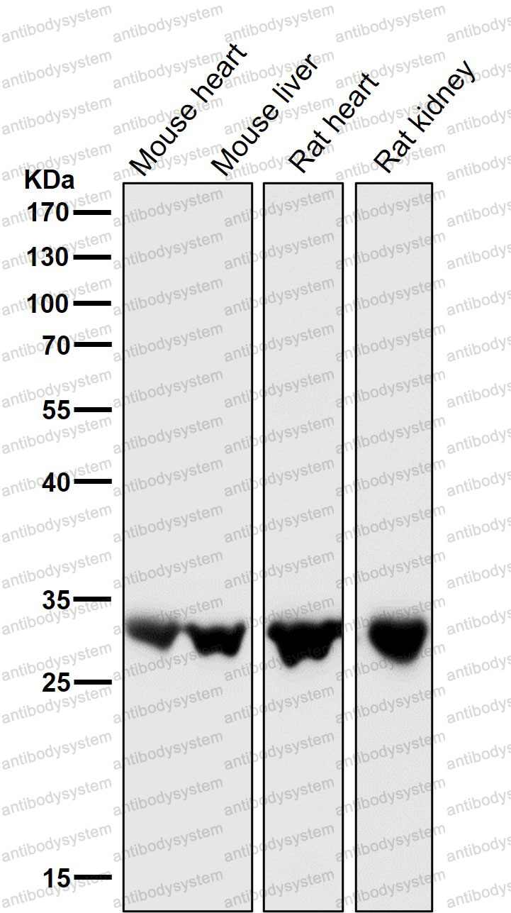 Anti-UPP1 Antibody (R2H58)