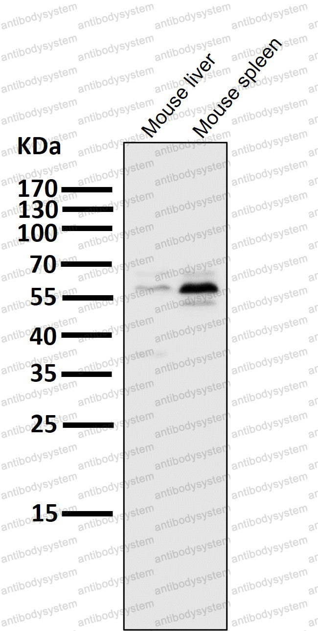 Anti-PFKFB3 Antibody (R2H59)