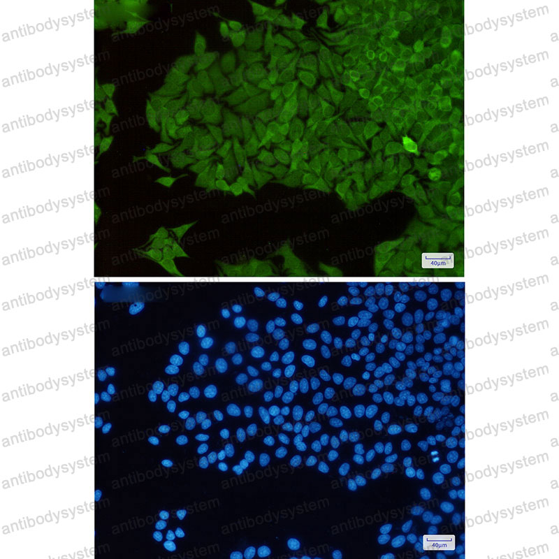 Anti-TXNRD1 Antibody (R2H62)