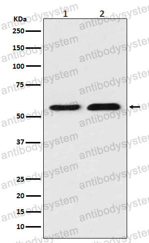 Anti-TXNRD1 Antibody (R2H61)