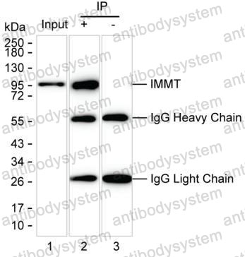 Immunoprecipitation for Anti-IMMT Antibody (R3U63) ?>