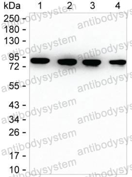 Western blot for Anti-IMMT Antibody (R3U63) ?>
