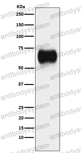 Anti-MICA Antibody (R2H65)