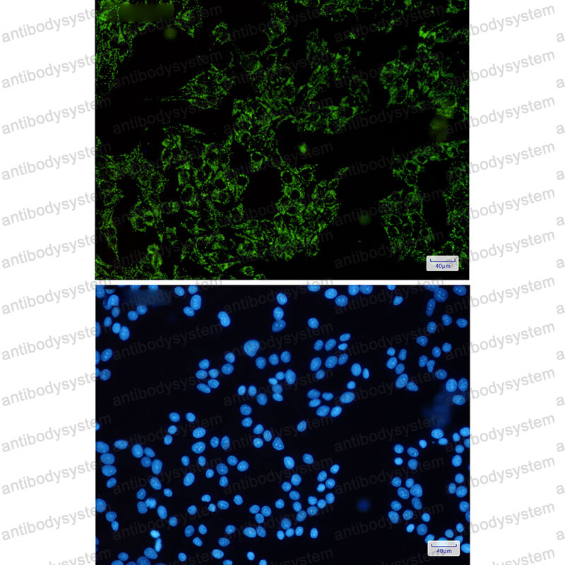 Anti-SGSM1 Antibody (R2H66)