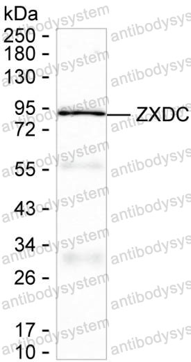 Western blot for Anti-ZXDC Antibody (R3U72) ?>