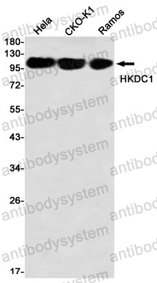Anti-HKDC1 Antibody (R2H67)